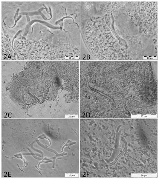 Micrographs of haptoral and male genital sclerotized structures from monogenean species belonging to Cichlidogyrus.