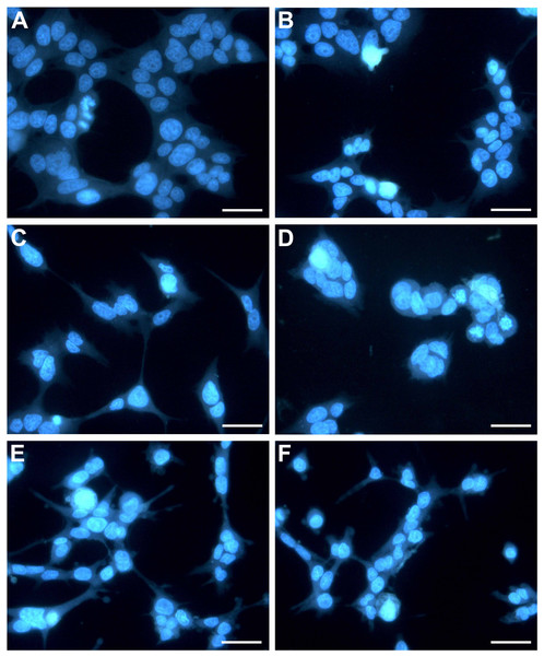 HepG2 cells exposed to CTH showing apoptotic features.