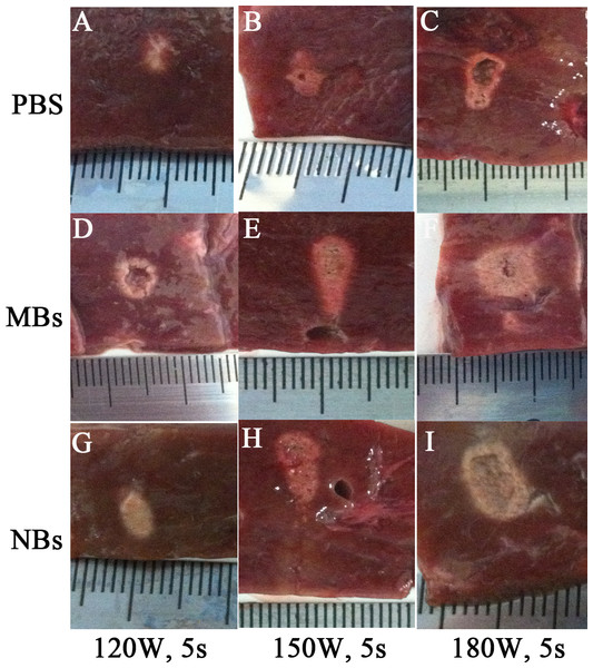 Photography of the targeted area in excised bovine liver after HIFU ablation.