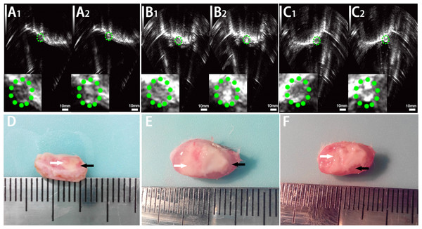 Ultrasonoscopy and photography of the targeted area in the rabbit breast tumor after HIFU ablation.