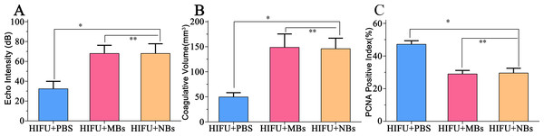 Quantitative analysis of echo intensity, coagulative necrosis volume and PCNA positive index in tumor tissue after HIFU ablation.