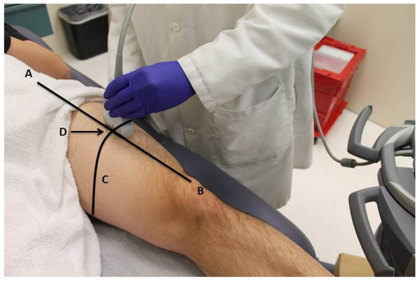 Participant positioning during ultrasound scanning procedure.