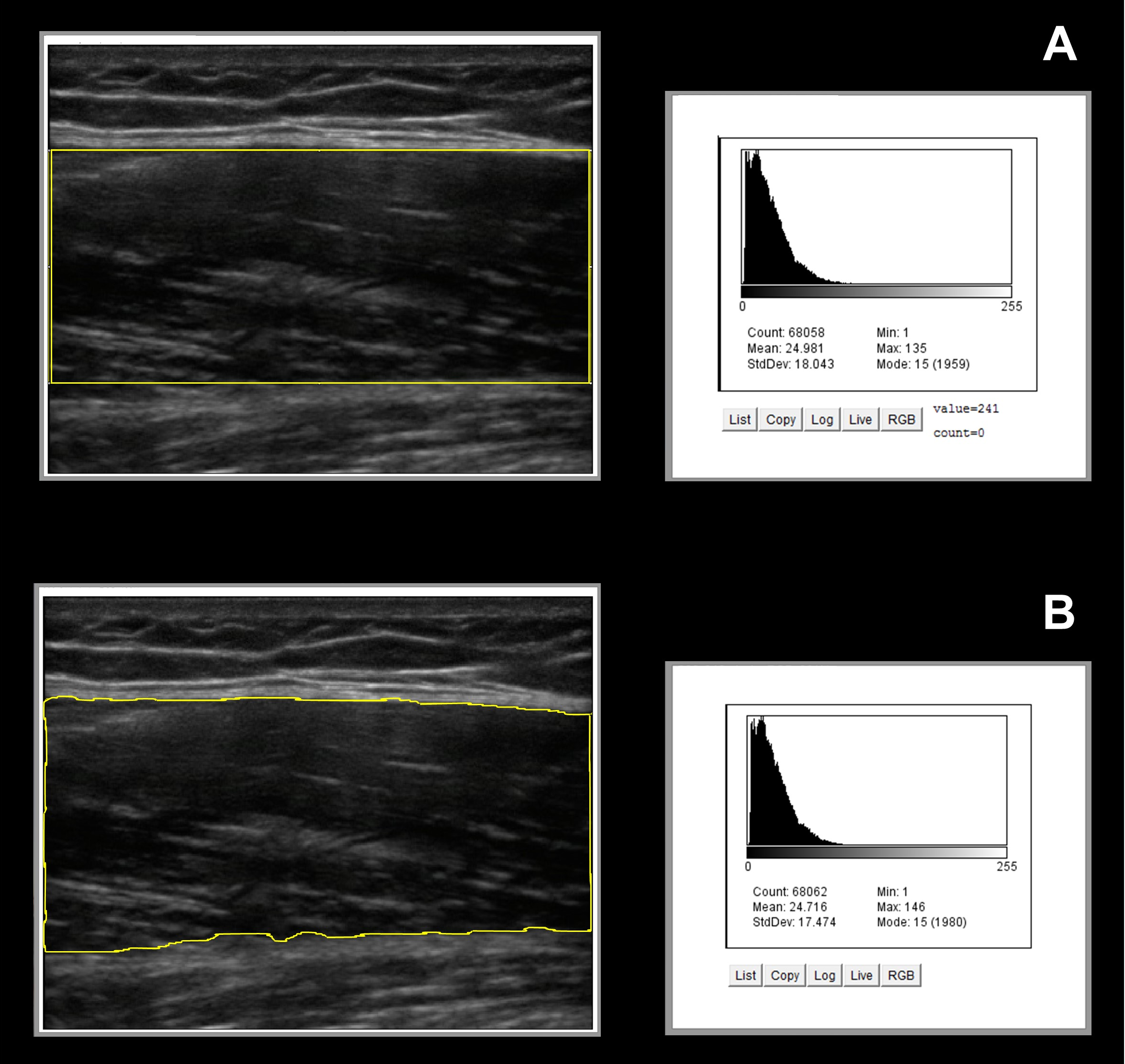 ultrasound histogram in older of adults muscle Ultrasound estimates quality