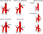 The origin of the medial circumflex femoral artery: a meta-analysis and ...