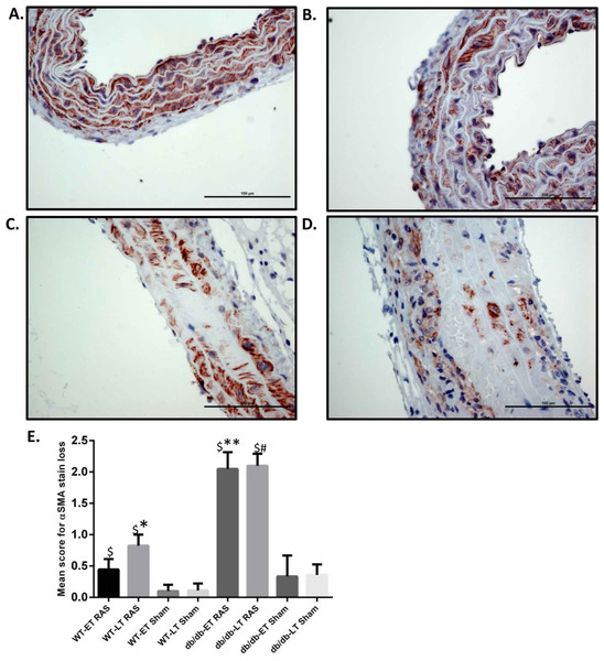 db/db mice showed more α smooth muscle actin loss in aorta at both early and late time points compared to WT.