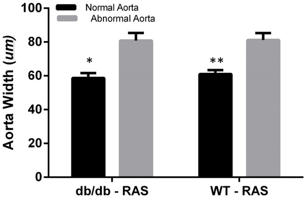 Abnormal aorta showed increased overall wall thickness.