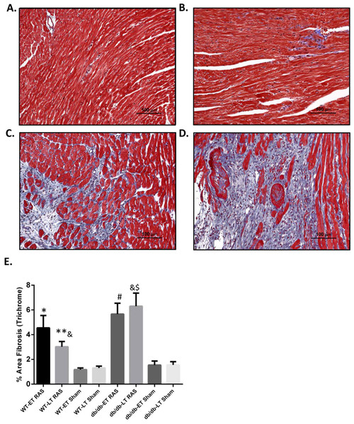 Increased cardiac fibrosis in db/db RAS mice compared to WT at later time points.