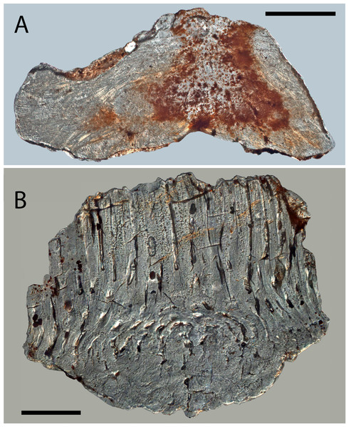 Histology of Solinalepis levis gen. et sp. nov. scales.