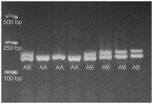 Results from analysis of 8 individuals on 2% agarose gel following PCR amplification as noted in ‘Methods.’