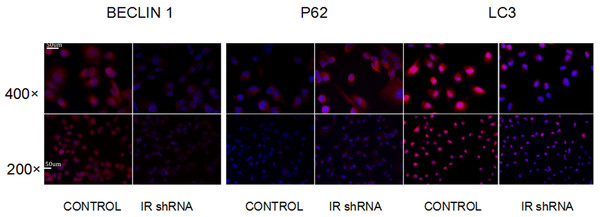Immunofluorescence of autophagy markers shows that autophagy was down-regulated after knockdown of IR.