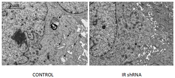 Electronic microscopy analysis of podocyte shows that autophagy was down-regulated after knockdown of IR.