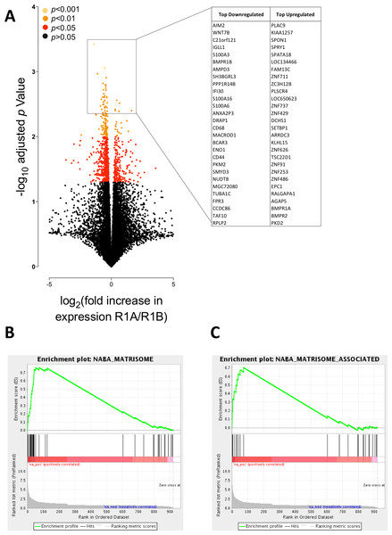 BMPR1A-biased BMP2 expression in soft tissue sarcomas.