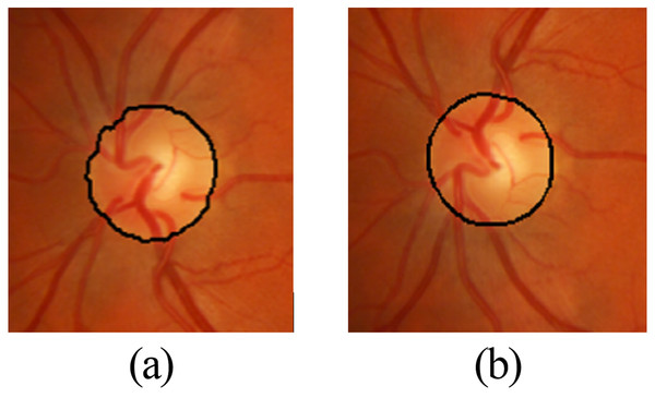 Close up view of (A) grow-cut segmentation; (B) approximation of grow-cut.