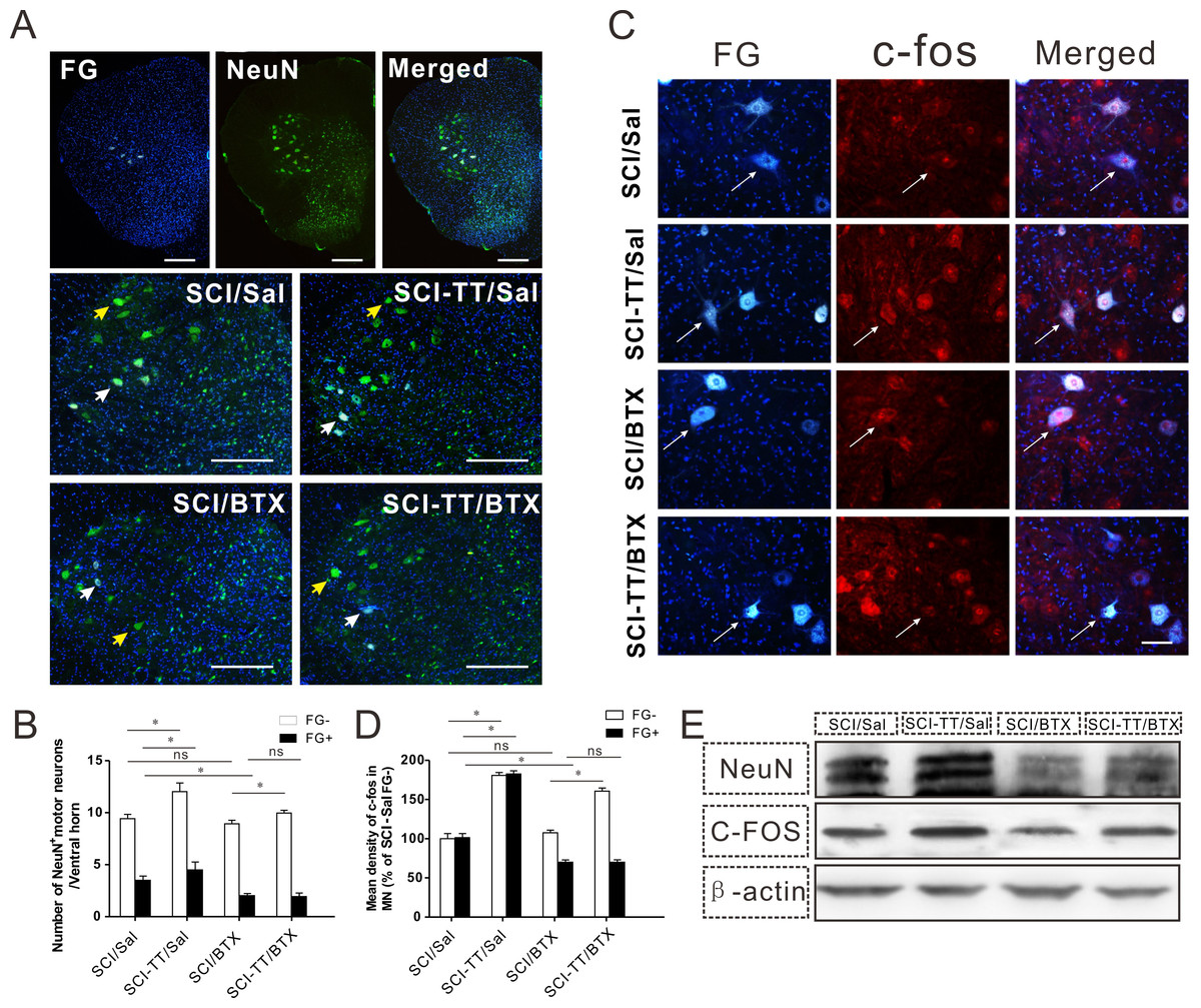 Neuromuscular Interaction Is Required For Neurotrophins-mediated ...