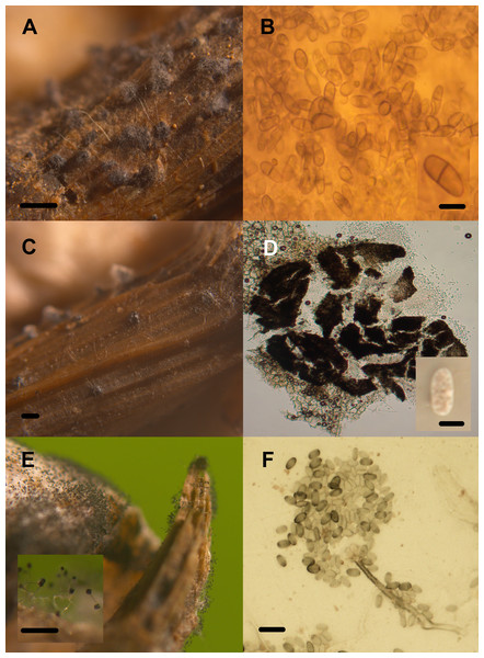 Transient lignocellulolytic aquatic fungi.