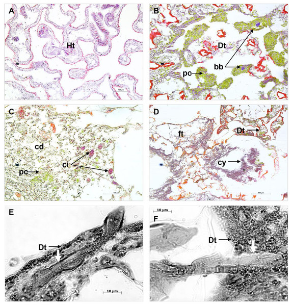 Histological sections of Porites lutea: (A) Ravine des Poux, (B) and (C) La Corne, and (D) Trou d’Eau in Reunion Island.