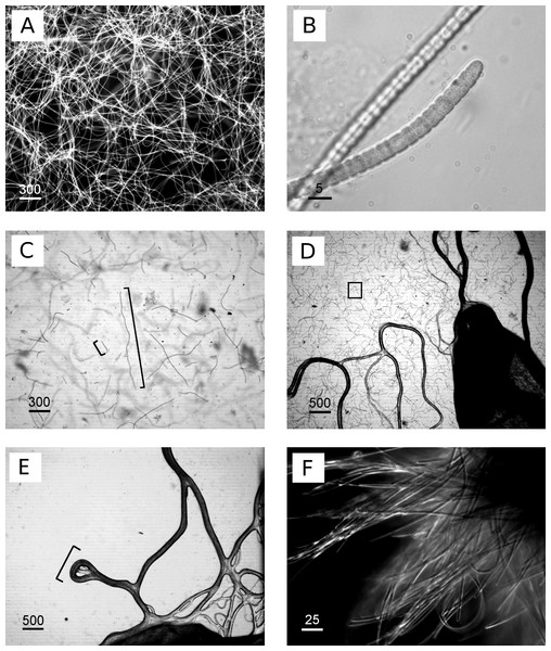 Images of cyanobacterium filament morphologies on agar and liquid cultures.