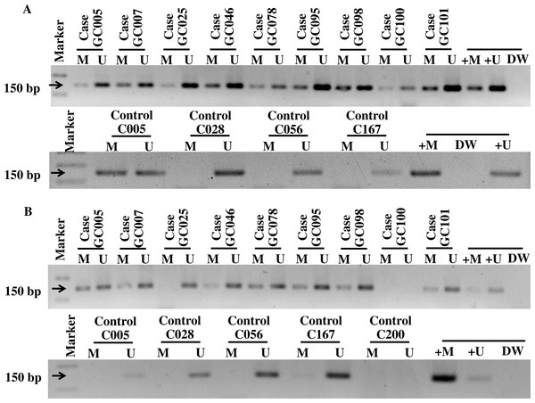 The gel electrophoresis of MS-PCR products for methylated (M), unmethelated (U), positive methylated (+M), normal saline (DW), and positive unmethylated (+U) in gastric cancer patients and controls; PDCH10 (A) and RASSF1A (B).