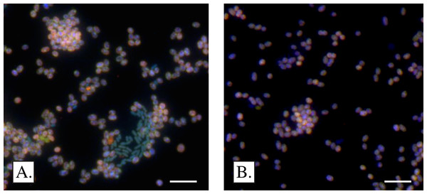 Microscopic appearance of Methylomarinum strain SSMP-1.