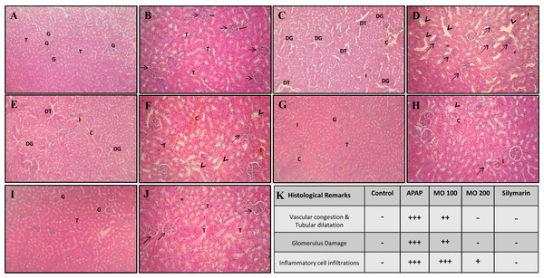 Photographs of Histopathological modification in kidney tissue.