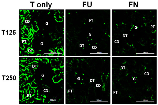 Effects of flutamide and finasteride on expression of β-ENaC in nephrons.