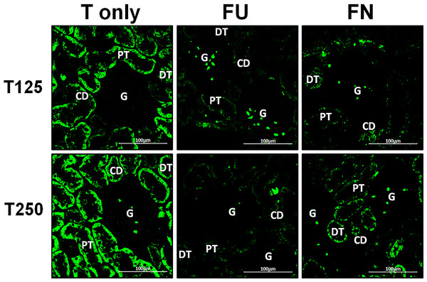 Effectsof flutamide and finasteride on expression of γ-ENaC in nephrons.