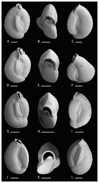 Holotype and paratypes of Miliolinella moia sp. nov.