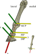 A preliminary case study of the effect of shoe-wearing on the ...