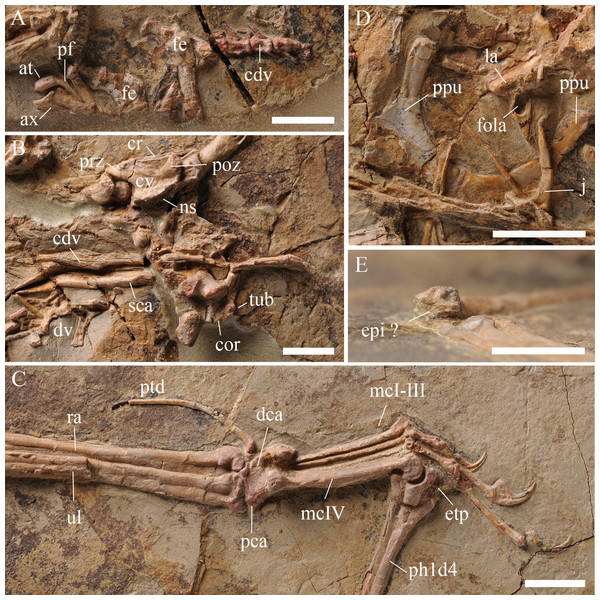 Details of the skeleton in IVPP V 17959.