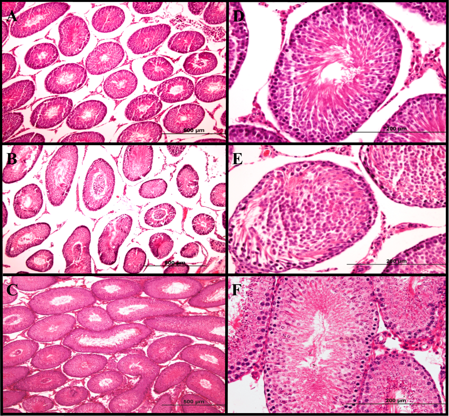 Altered expression profile of glycolytic enzymes during testicular ...