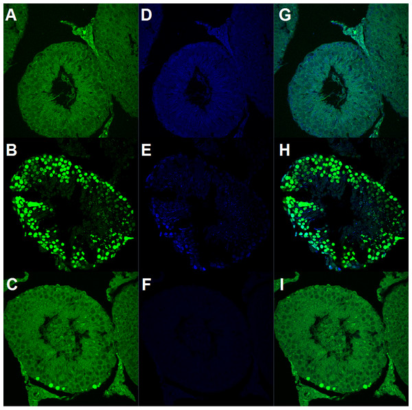Germ cell apoptosis (GCA) assessed by TUNEL immunohistofluorescence.