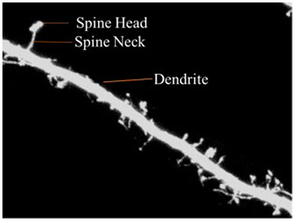Dendritic spine.