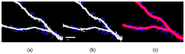 Spine detection result of ROI_ 1 via (A) Manual (B) Su’s method (C) RTSVM.