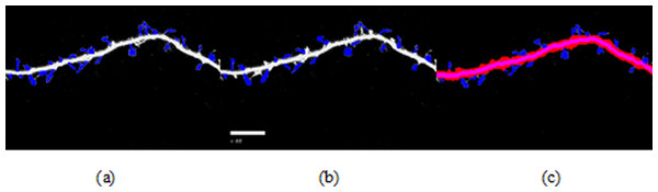 Spine detection result of ROI_ 2 via (A) Manual (B) Su’s method (C) RTSVM (our).