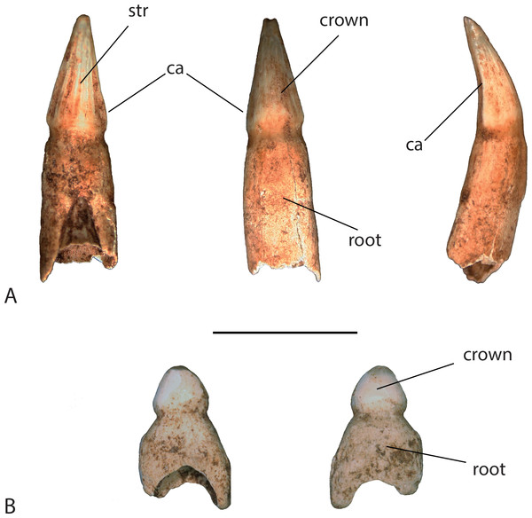 Teeth found in association with UAP-03.791.