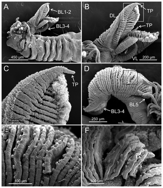 SEM micrographs of paratypes of Terebellides hutchingsae spec. nov. from Thailand.