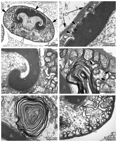 Transmission electron micrographs of Cambarus robustus spermatozoon.