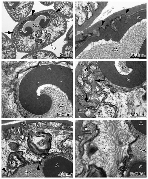 Transmission electron micrographs of Orconectes rusticus spermatozoon.