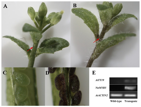 Functional analysis of NnMYB5 in transgenic plants.