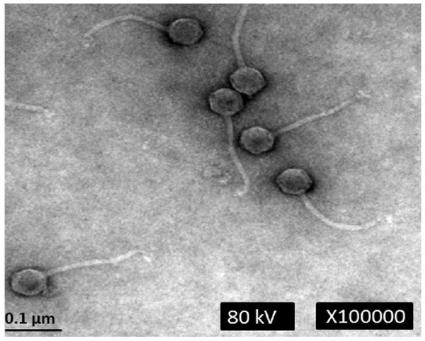 Transmission electron micrograph of phage phiC119 negatively stained with 2% unanyl acetate.