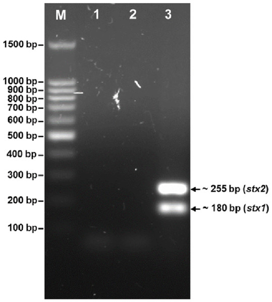 Agarose gel electrophoresis of PCR products amplified from DNA extracted from phage phiC119.