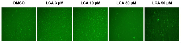 Lithocholic acid (LCA) induces autophagy in PC-3 prostate cancer cells.