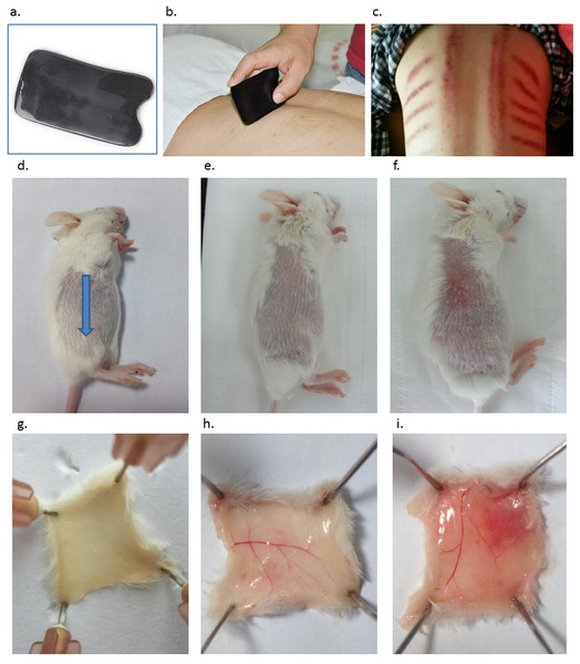 Introduction of Gua Sha and representative anatomic images of Gua Sha treatment on mouse skin.