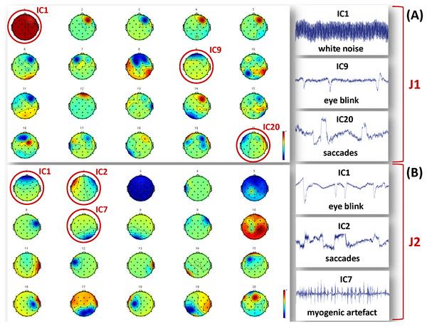 Examples of artefactual ICs separated from the EEG recordings of J1 and J2.