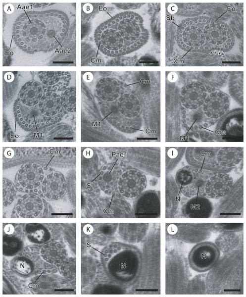 Cross-sections of the mature spermatozoon of Opisthomonorchis dinema observed in TEM.