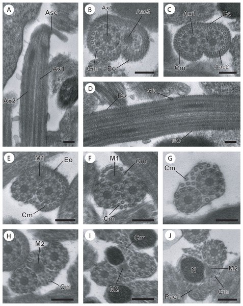 Regions I−III of mature spermatozoon of Paramonorcheides selaris observed in TEM.