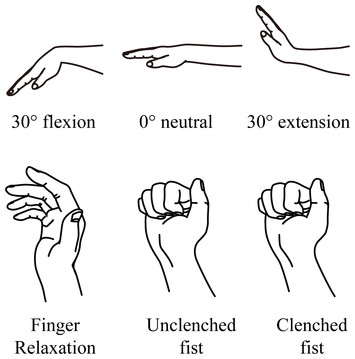 Effects of grip force on median nerve deformation at different wrist ...