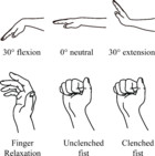 Effects of grip force on median nerve deformation at different wrist ...