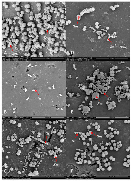 The cell population of dual-species biofilms (S. sanguinis (Ss) +S. mutans (Sm)) viewed by Scanning Electron Microscopy (SEM) where the pellicle was treated with PEM (C) and its respective plant extracts (Psidium sp. (D); Mangifera sp. (E) and Mentha sp. (F)) on cell adherence.
