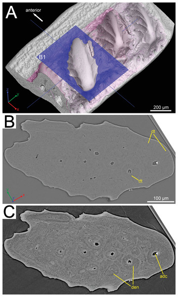 Histological detail of a large odontode of (GIT 727-1).